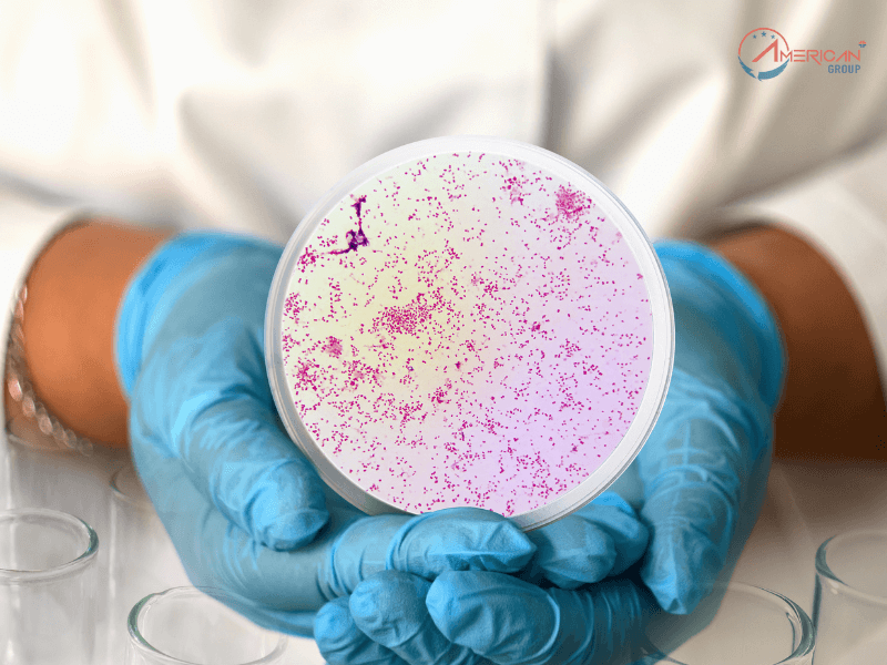 Danh Sách Bệnh Không Được Chấp Thuận Định Cư Mỹ Cập Nhật 2024 Bệnh giang mai giai đoạn truyền nhiễm (Syphilis)